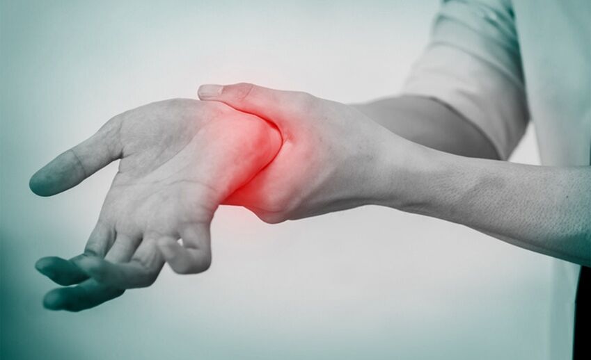 Schmerzen bei Arthrose des Handgelenks